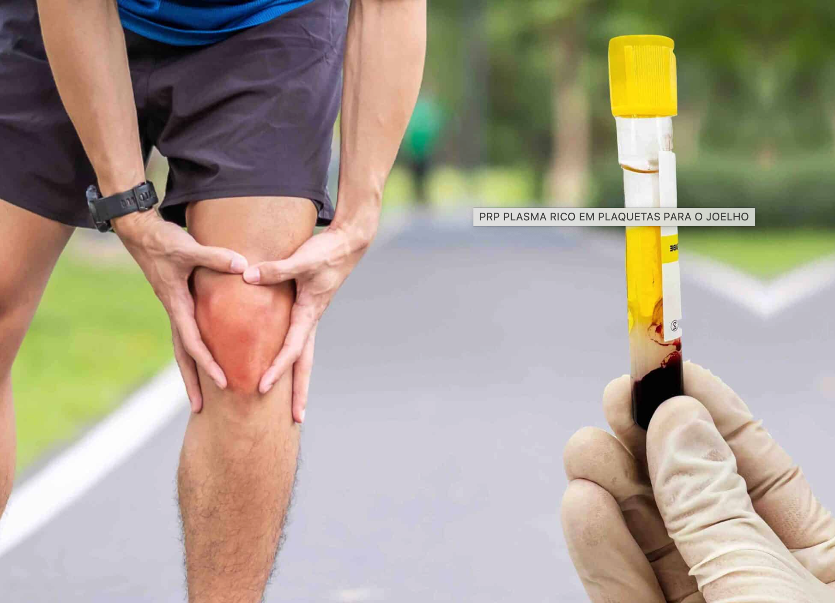 Atleta com dor no joelho e tubo de PRP - Plasma Rico em Plaquetas para lesões musculares